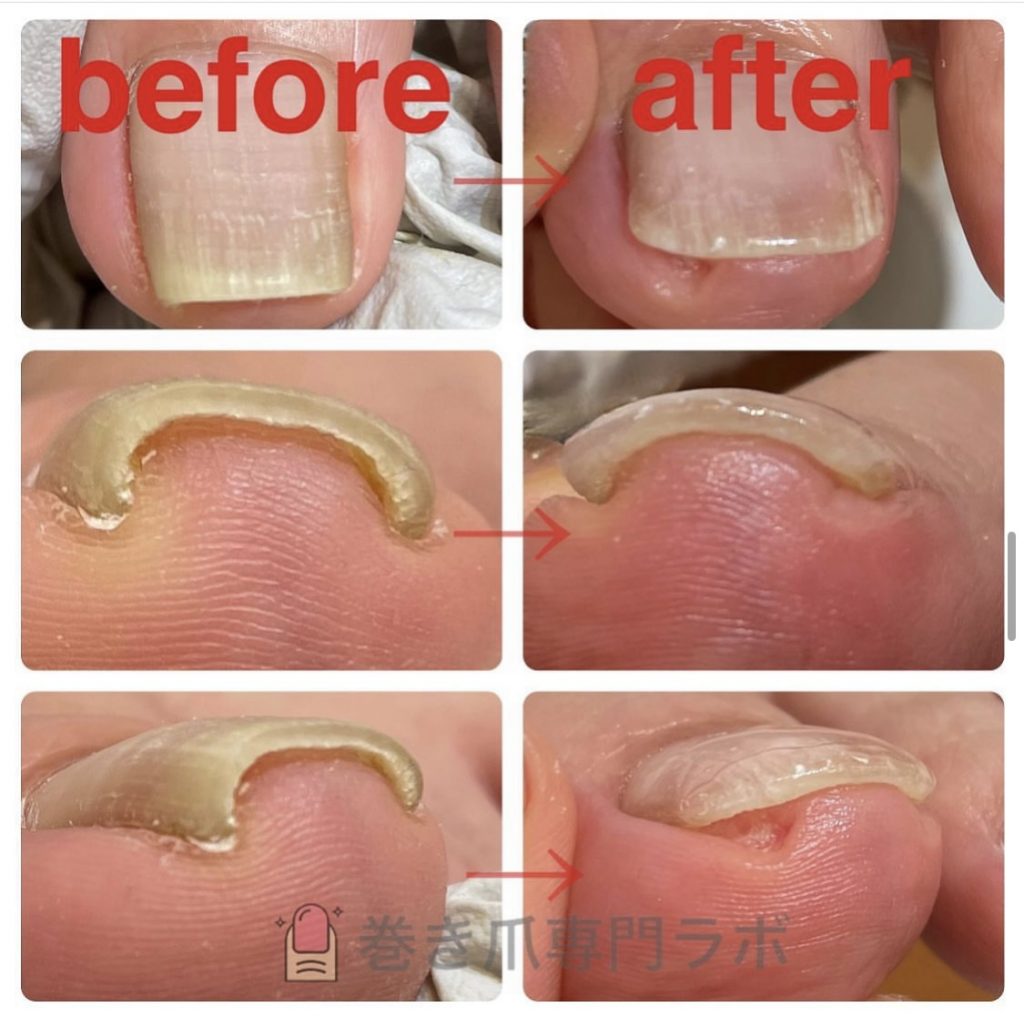 綺麗に広がります☆