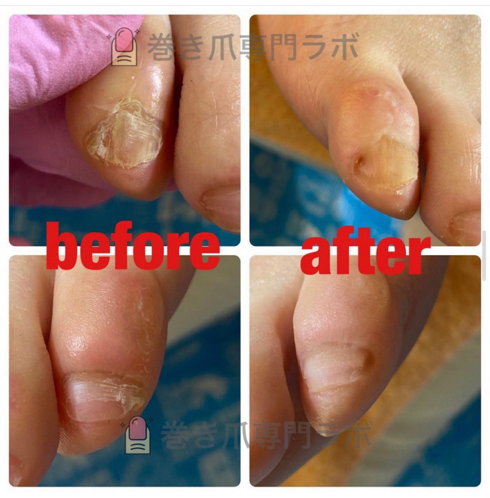 副爪とは。。😳