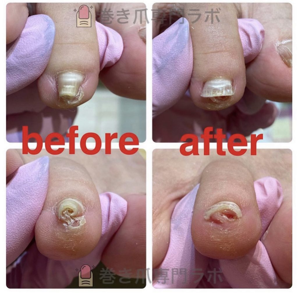 跡がくっきり😳