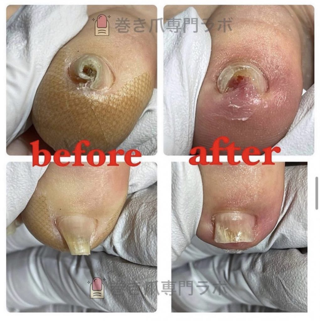 爪切りも大変💦