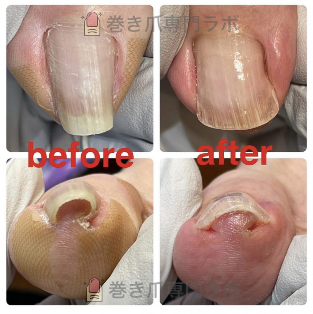 痛みが出る前に🤲🏻