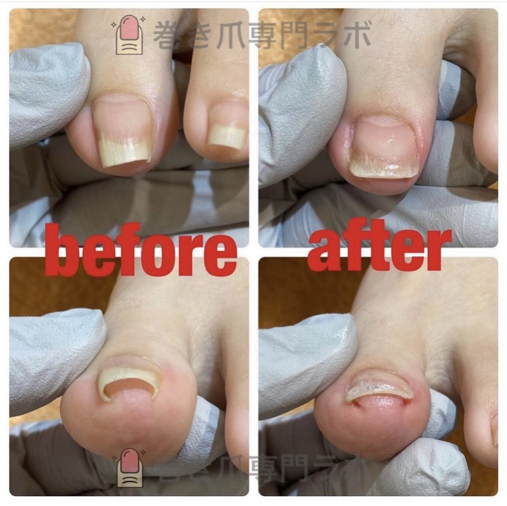 爪をよく見ると👀