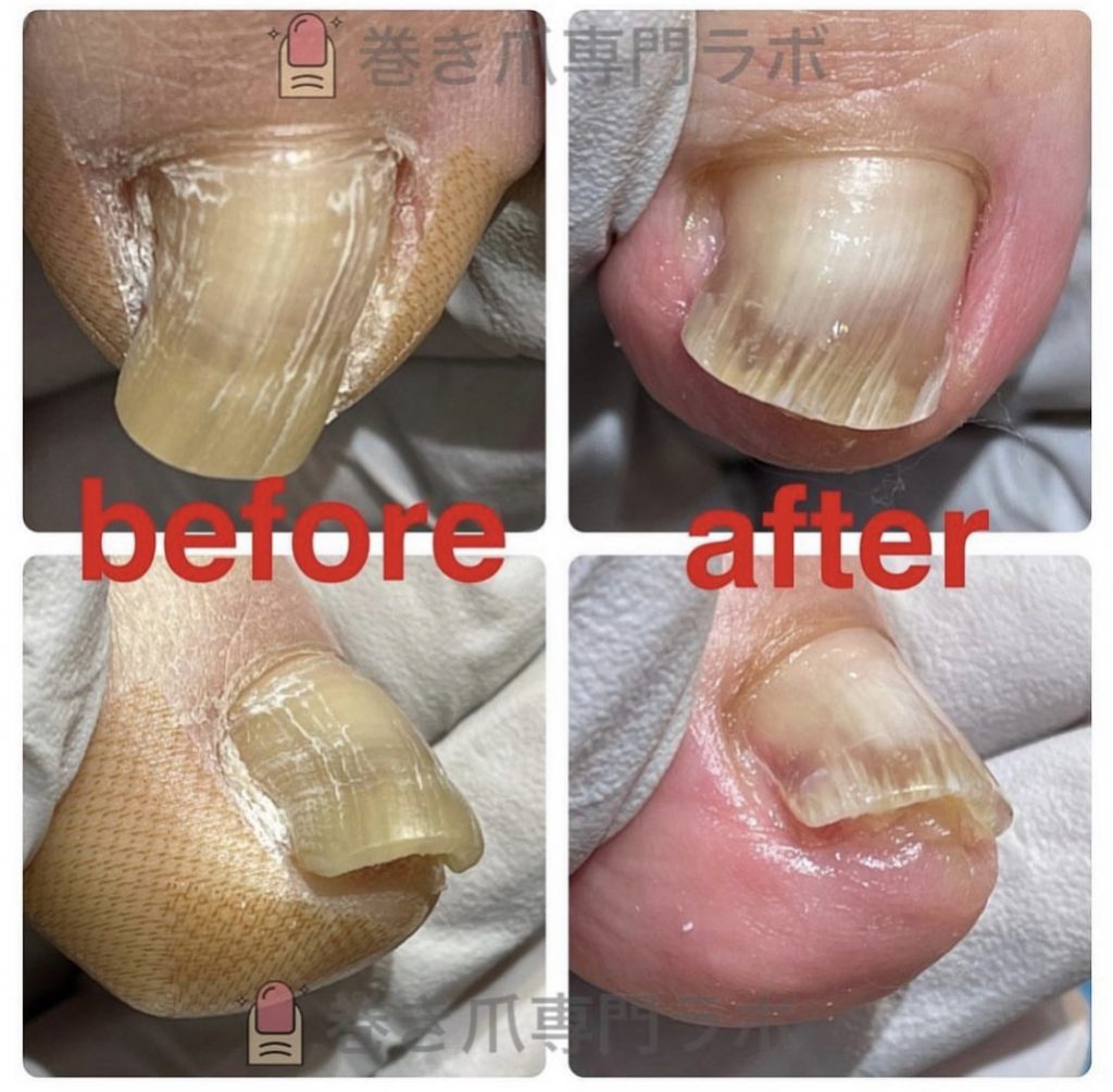 健康的なお爪の色に✨