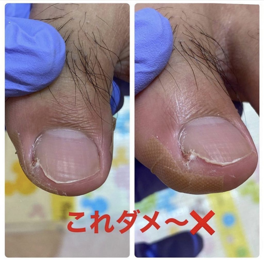 正しい爪の切り方☝🏻