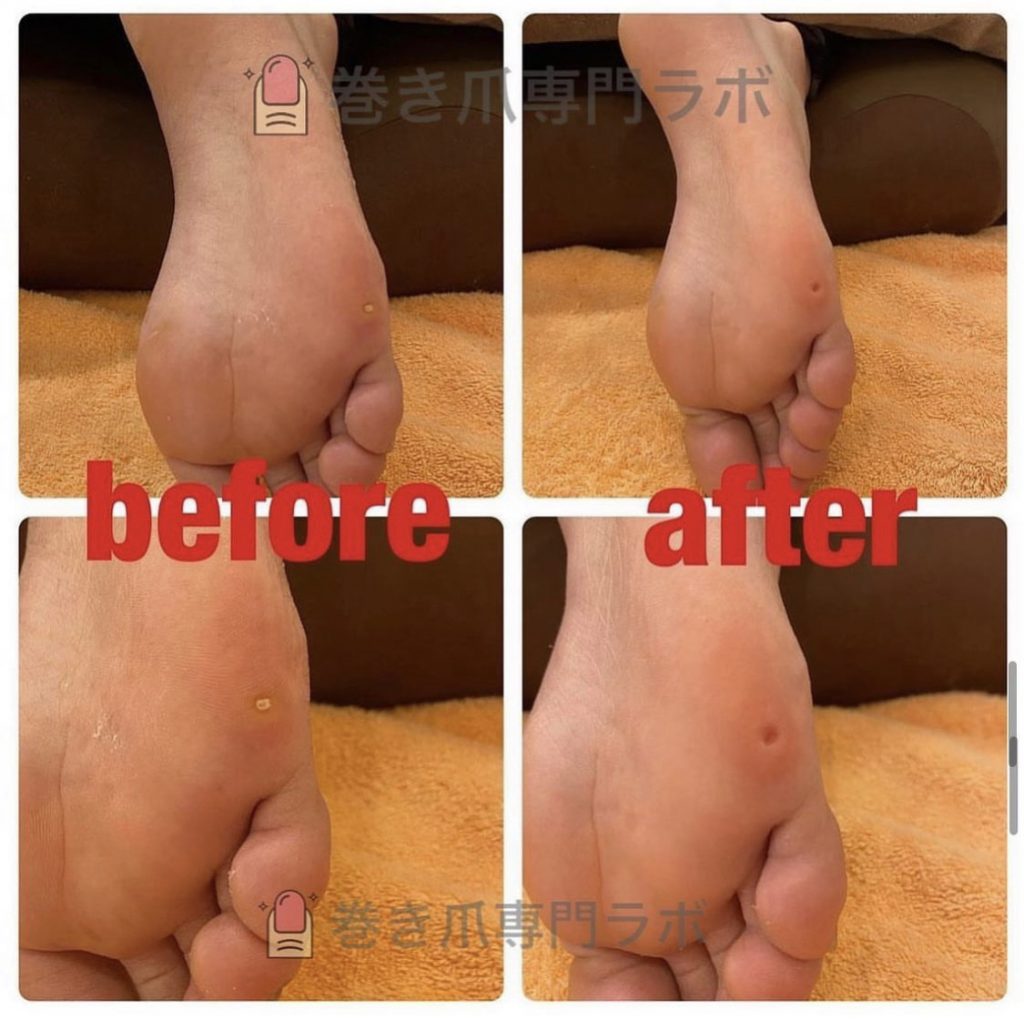 小さな魚の目でも💦