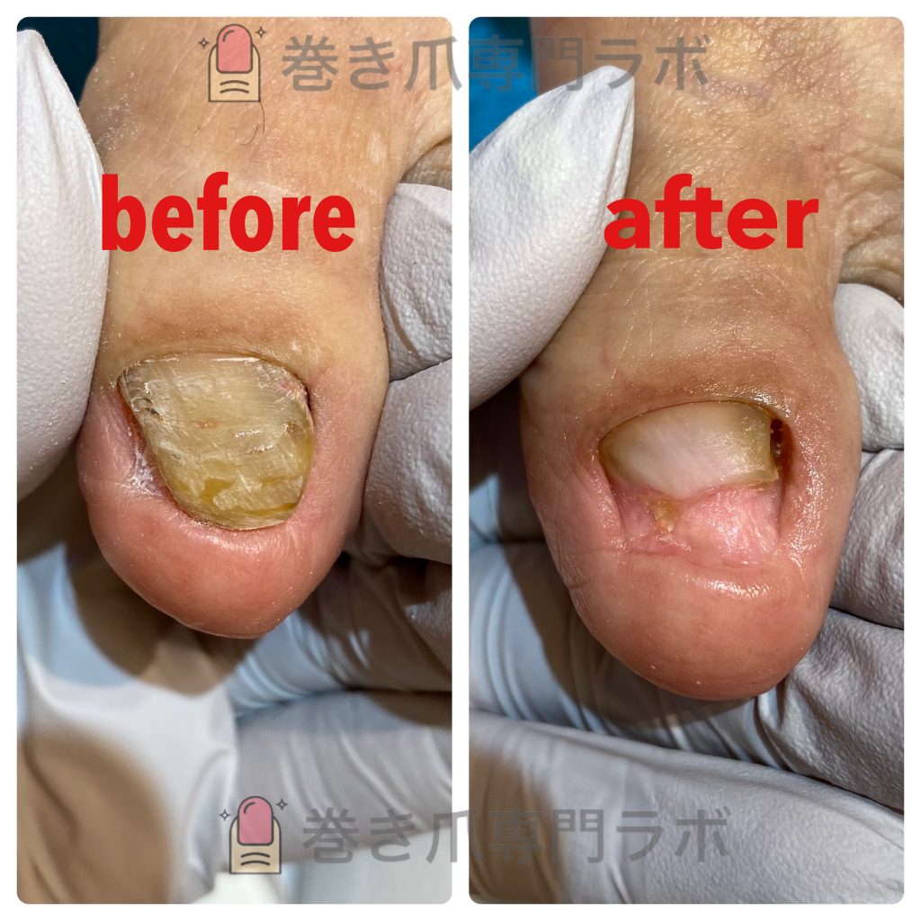 厚みが出てしまう