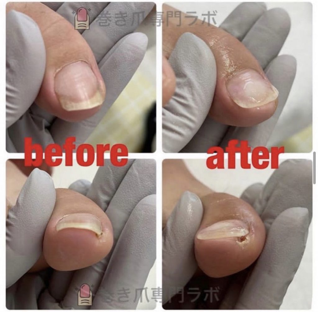 ポッカリ穴が😳