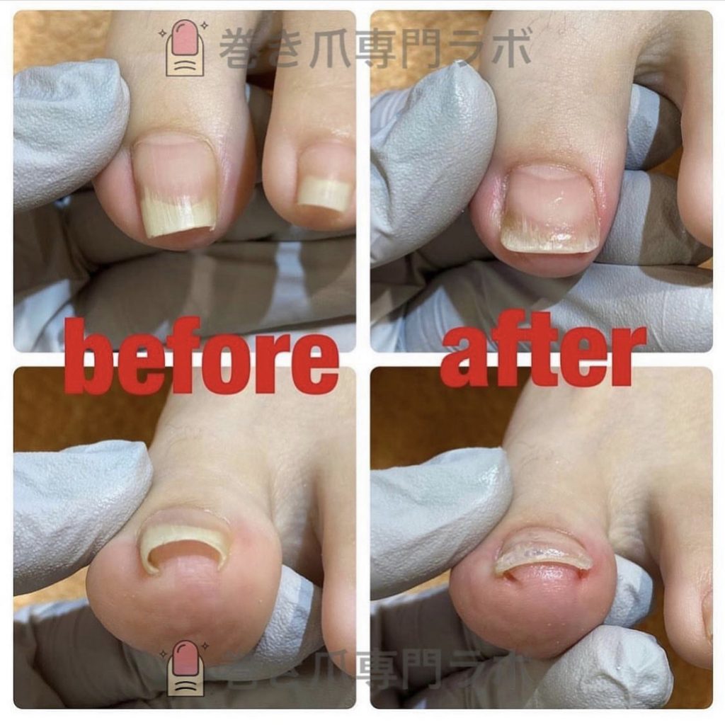 正面から見ると。。🧐