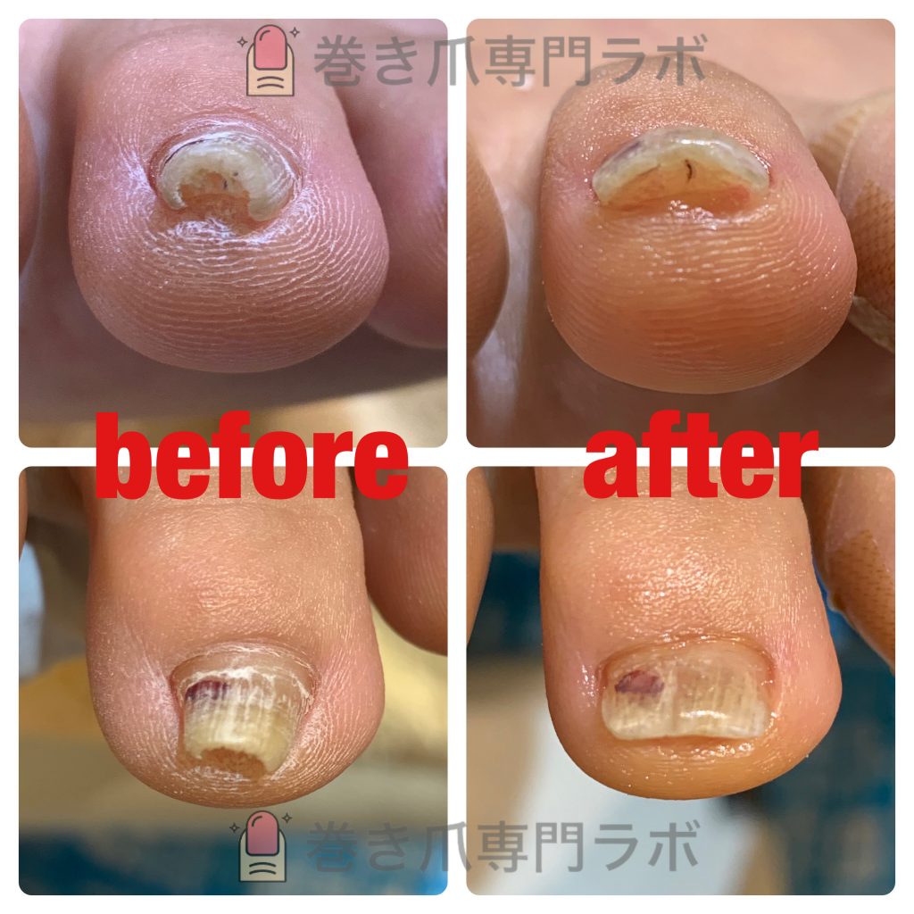 引っかかりが気になる方注意🧐