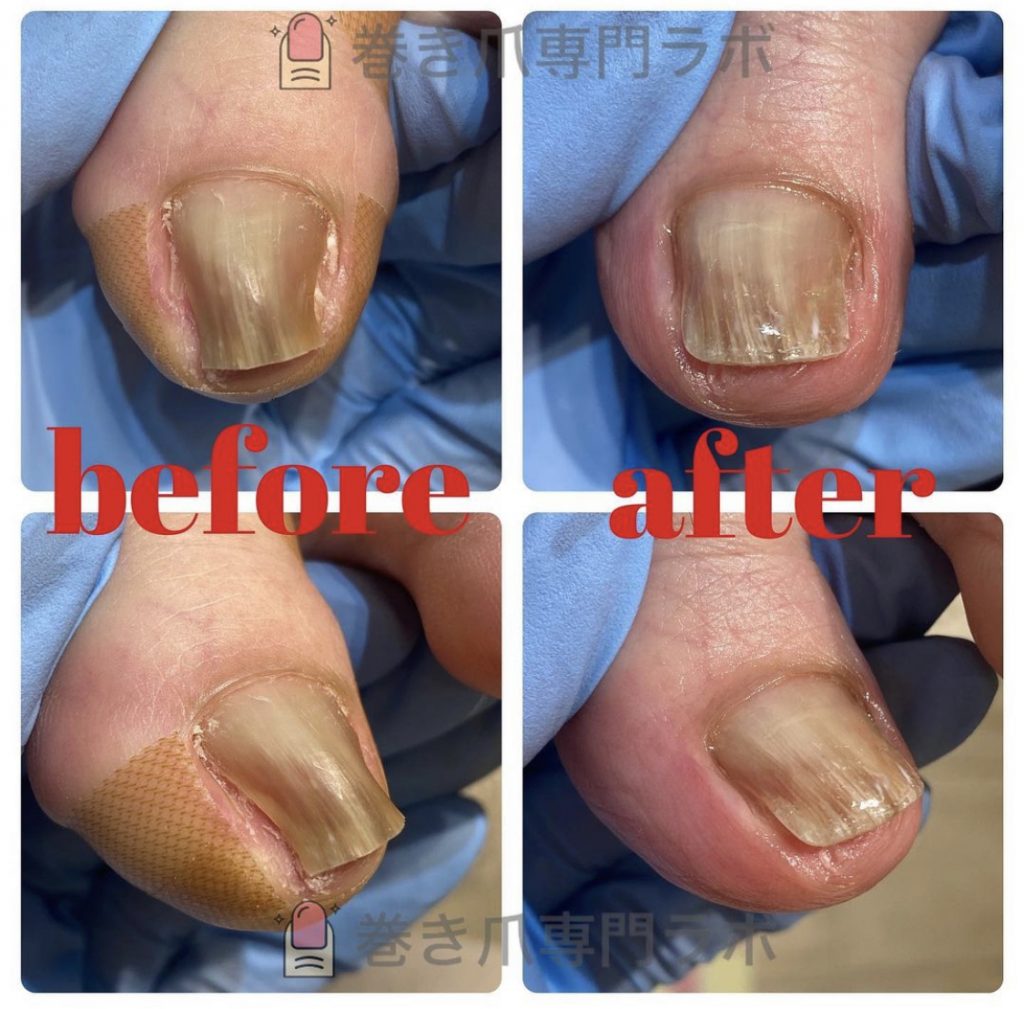 拡がったお爪を見て感動✨