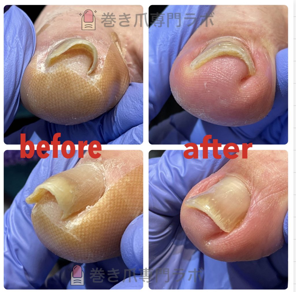 お爪の伸びる方向