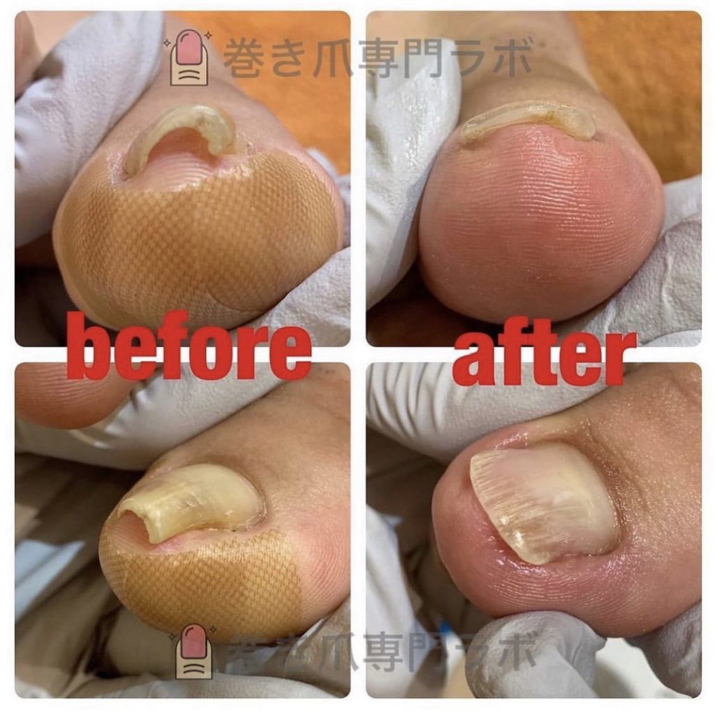 圧迫での痛み💦