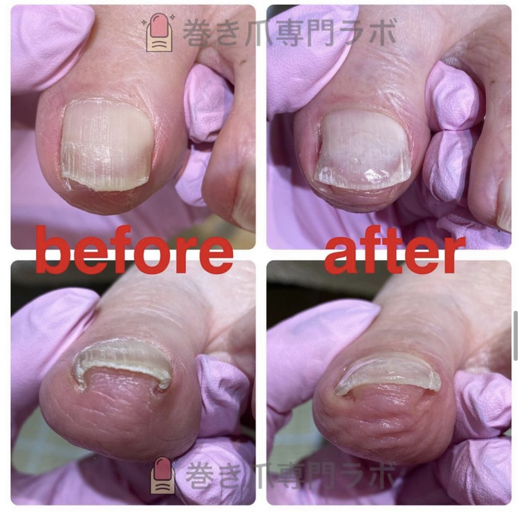 歩き方も大切！！