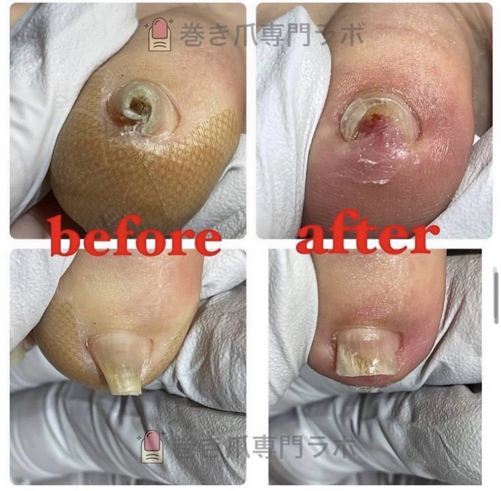 ぐるっと一周🌀