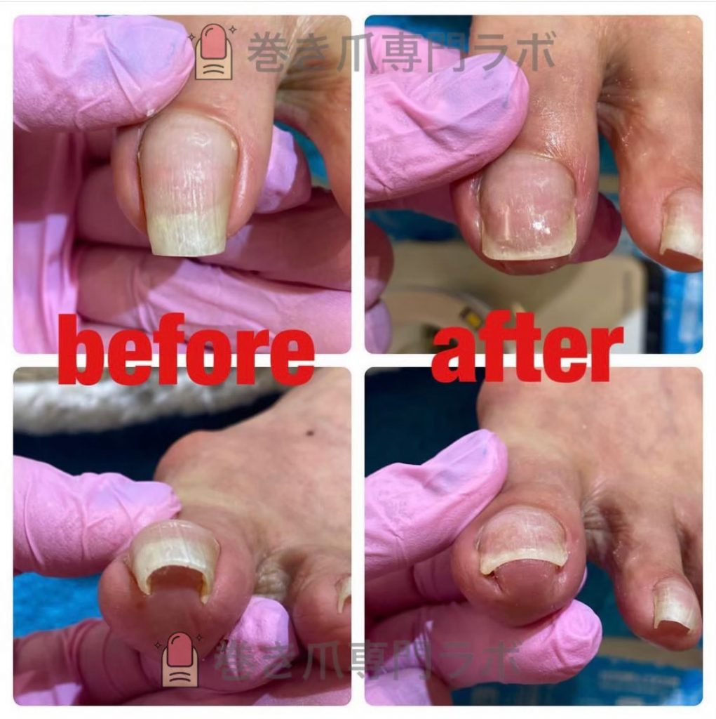 自然な仕上がり