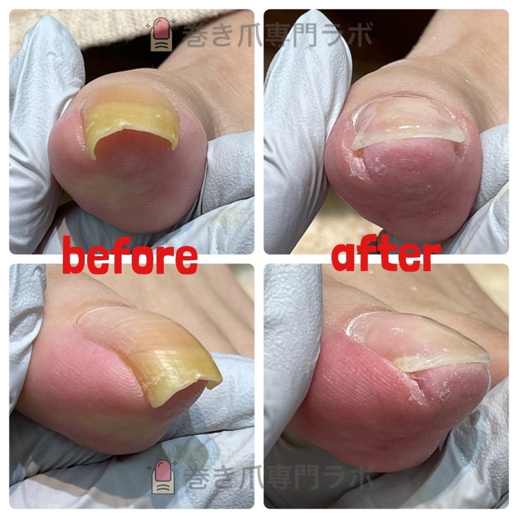 爪切りだけでもどうぞ