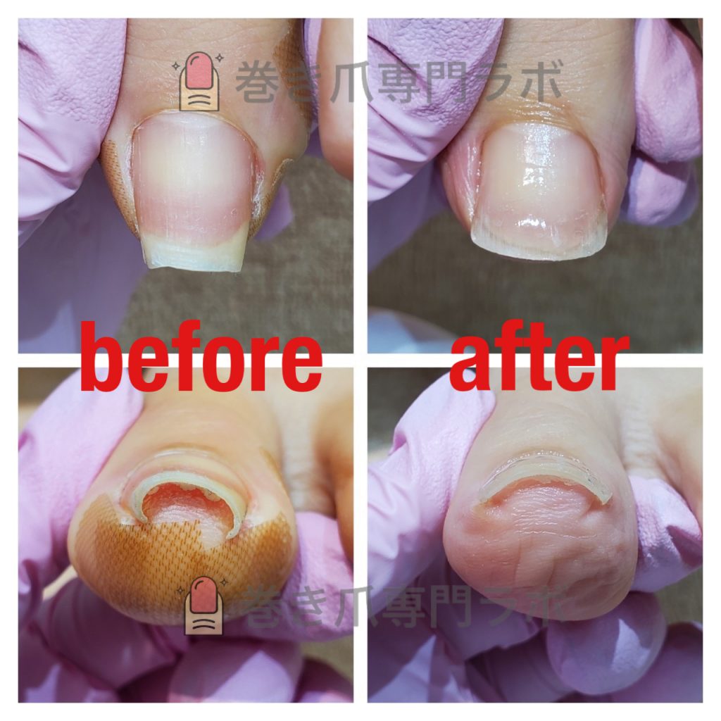 綺麗に広がりました！