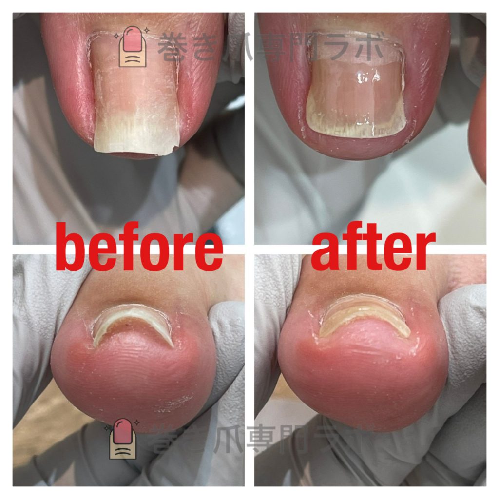 慎重に、慎重に。