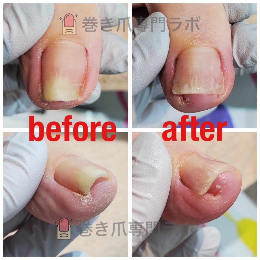 ゴミや垢が溜まるところ