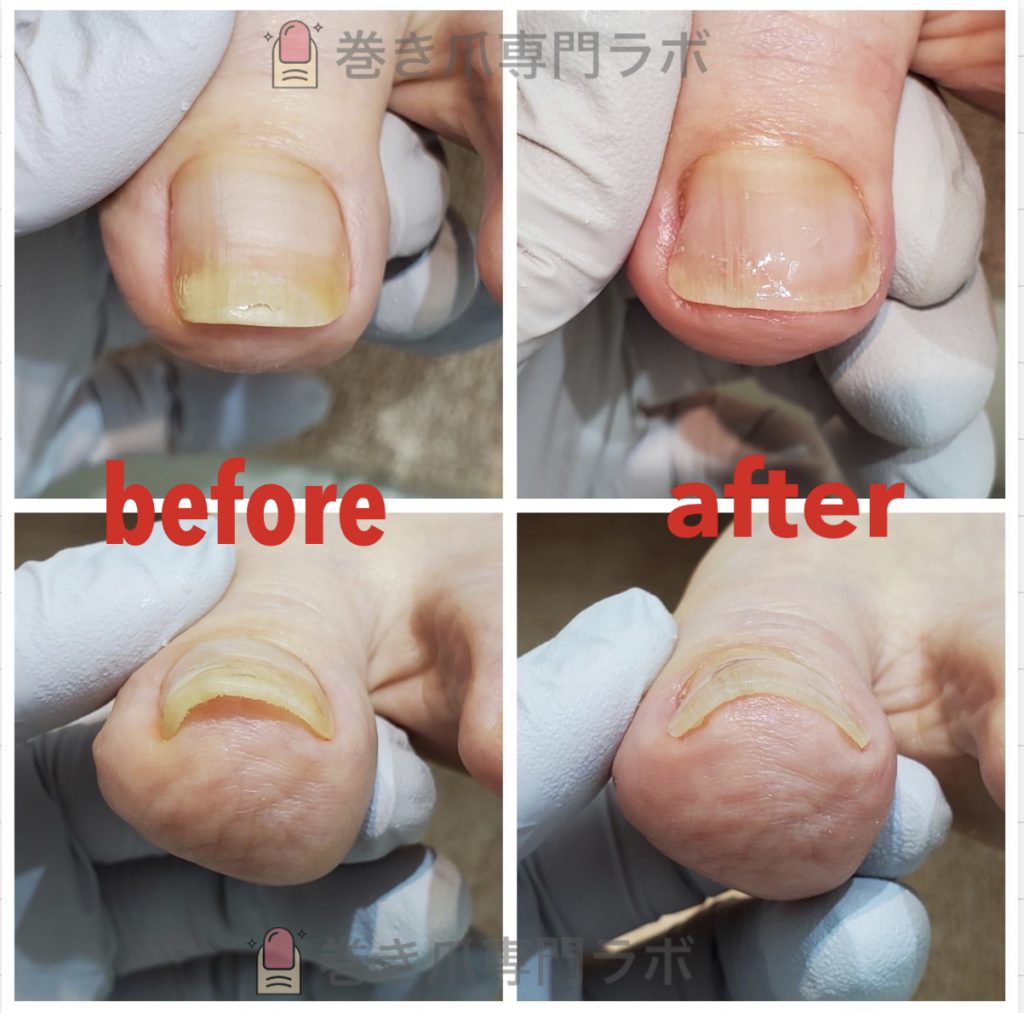 お爪のお悩みをお気かせ下さい