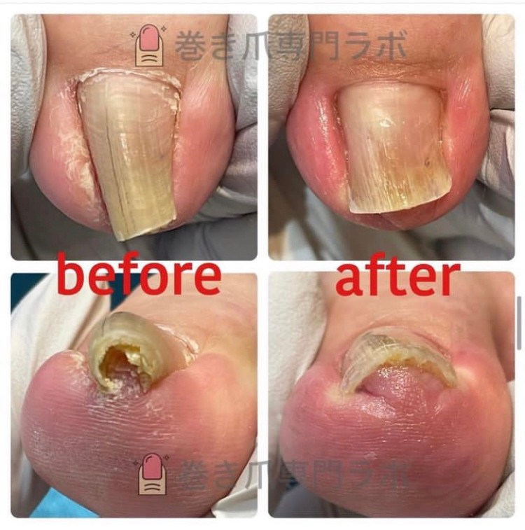 歩き方も大事です