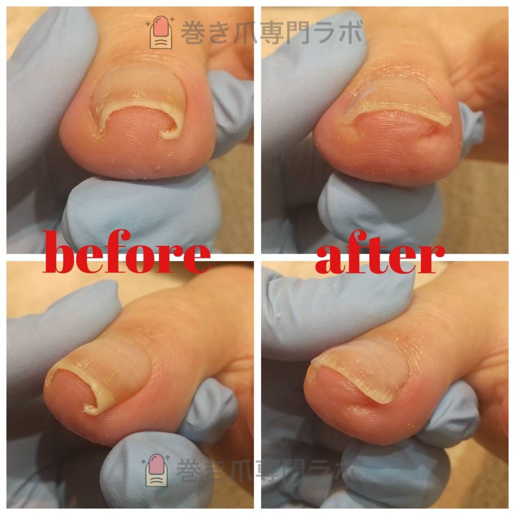 拡がりましたね♪