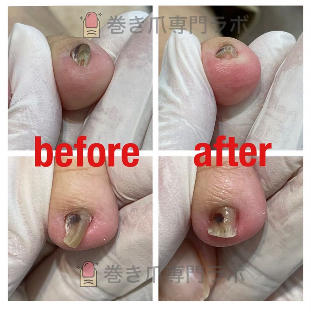 親指以外も✨🙌🏻