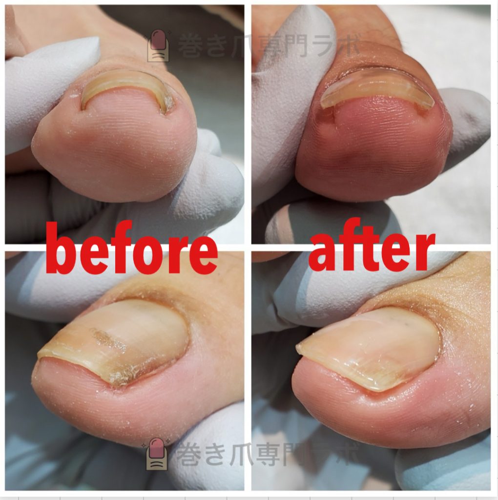 ケアもしっかり