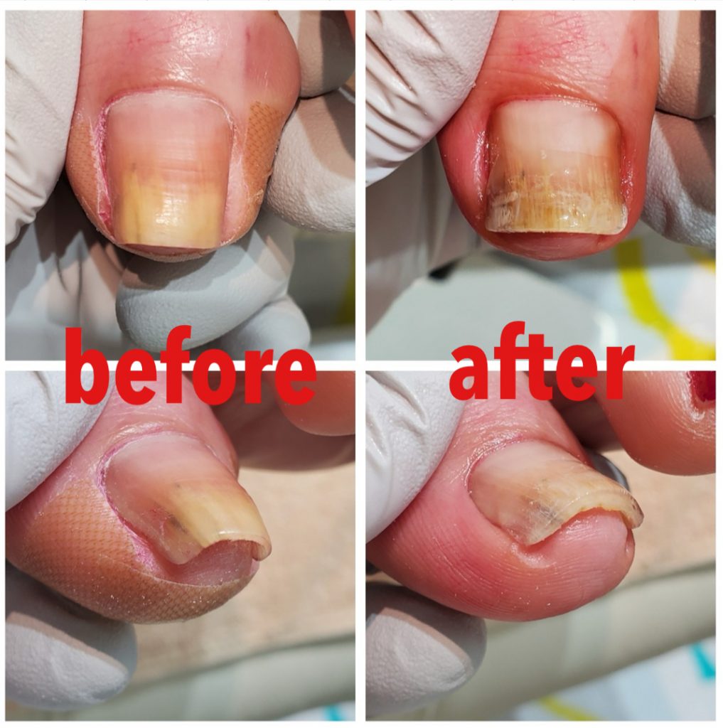 痛みが軽減されました！