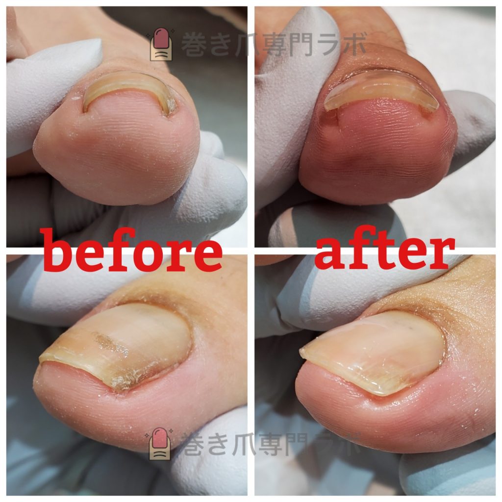 健康な足を保つ為にも