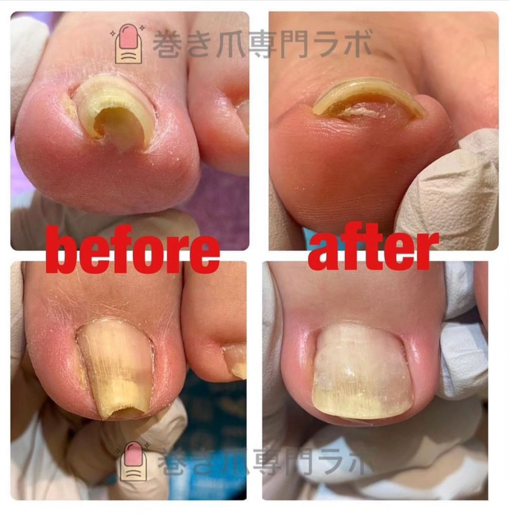 健康的なお爪へ。。✨