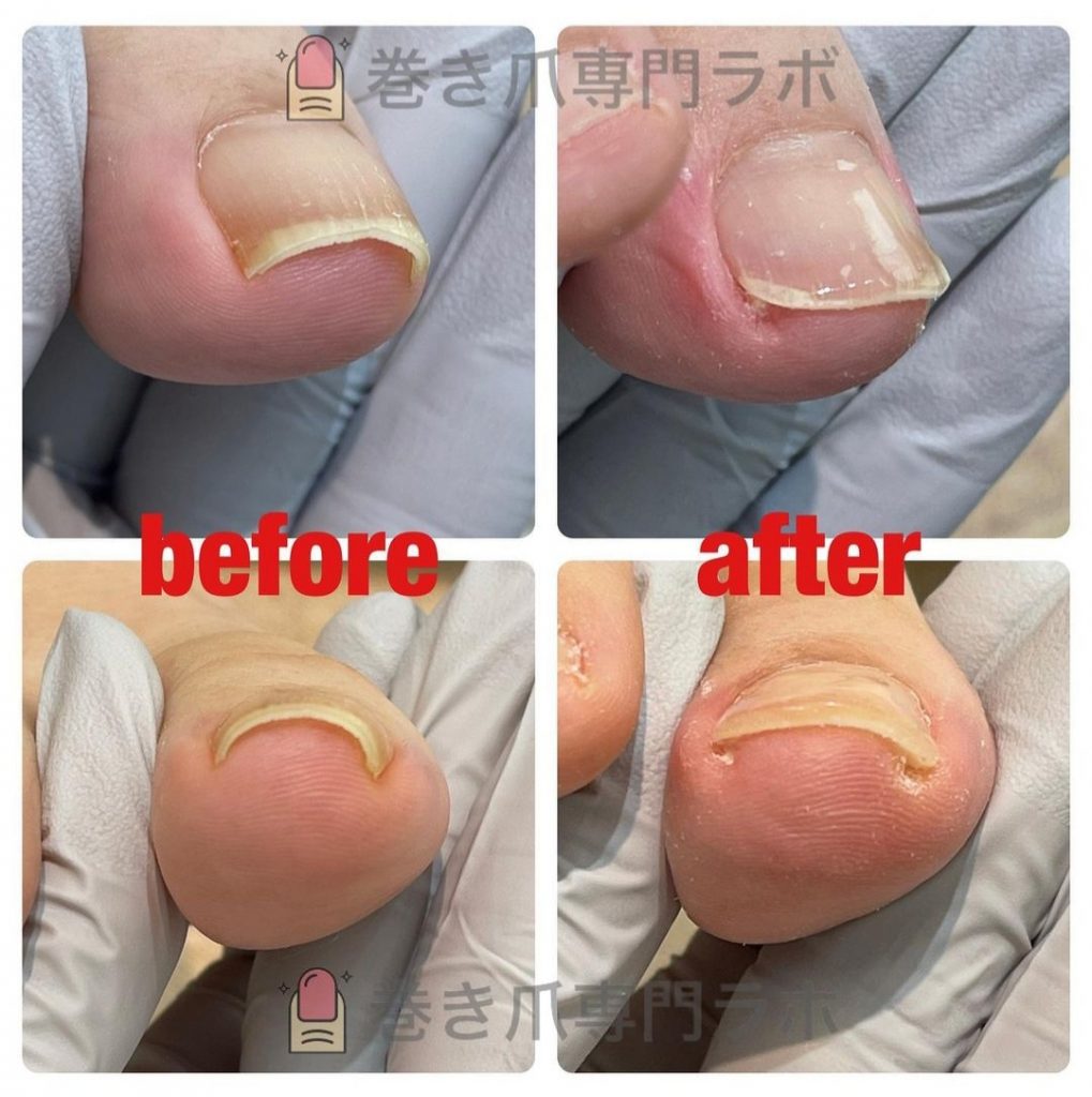 1度でこの変化！