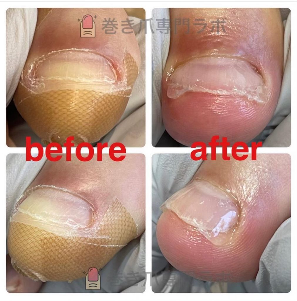 お爪の長さ大事です