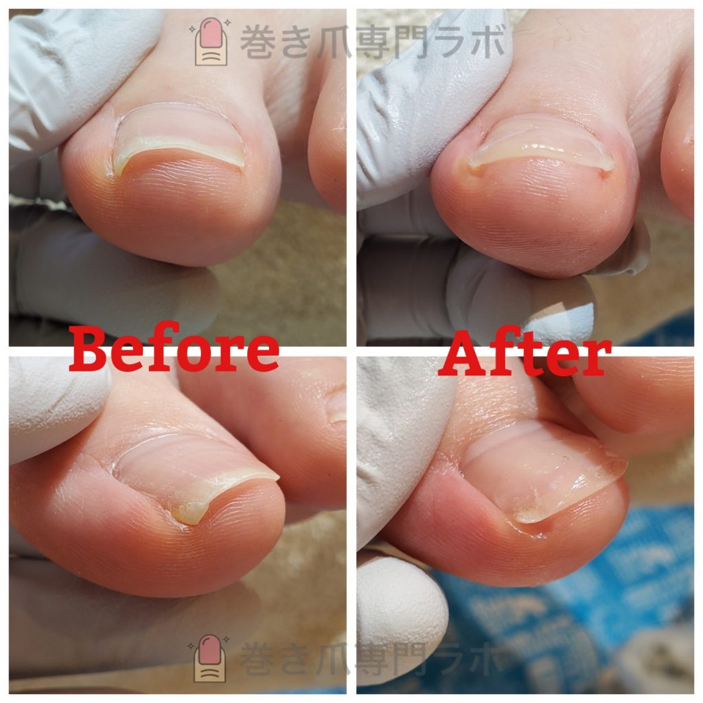 お爪に違和感。。