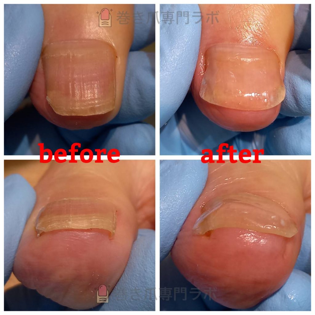 フラットに見えても…