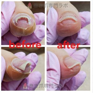 お爪切りもおまかせ下さい