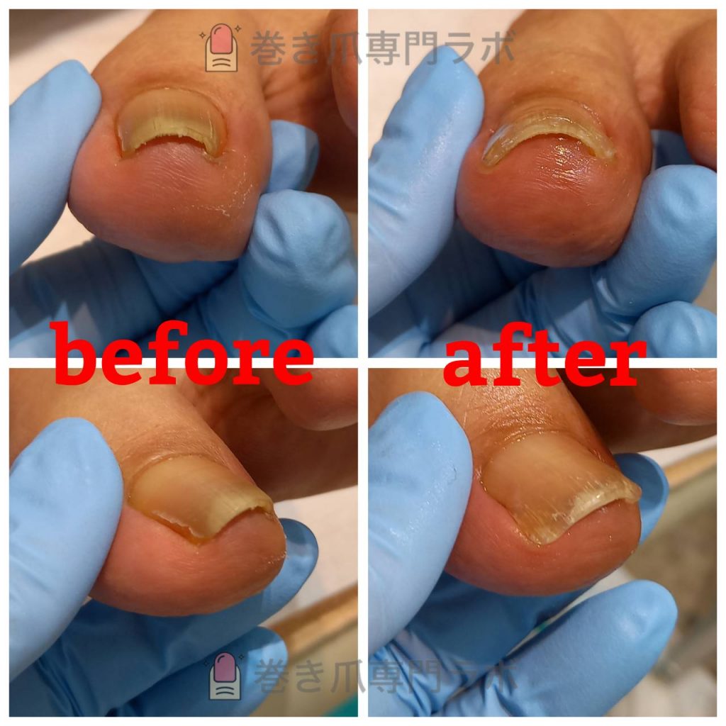 不調が始まる前に☆