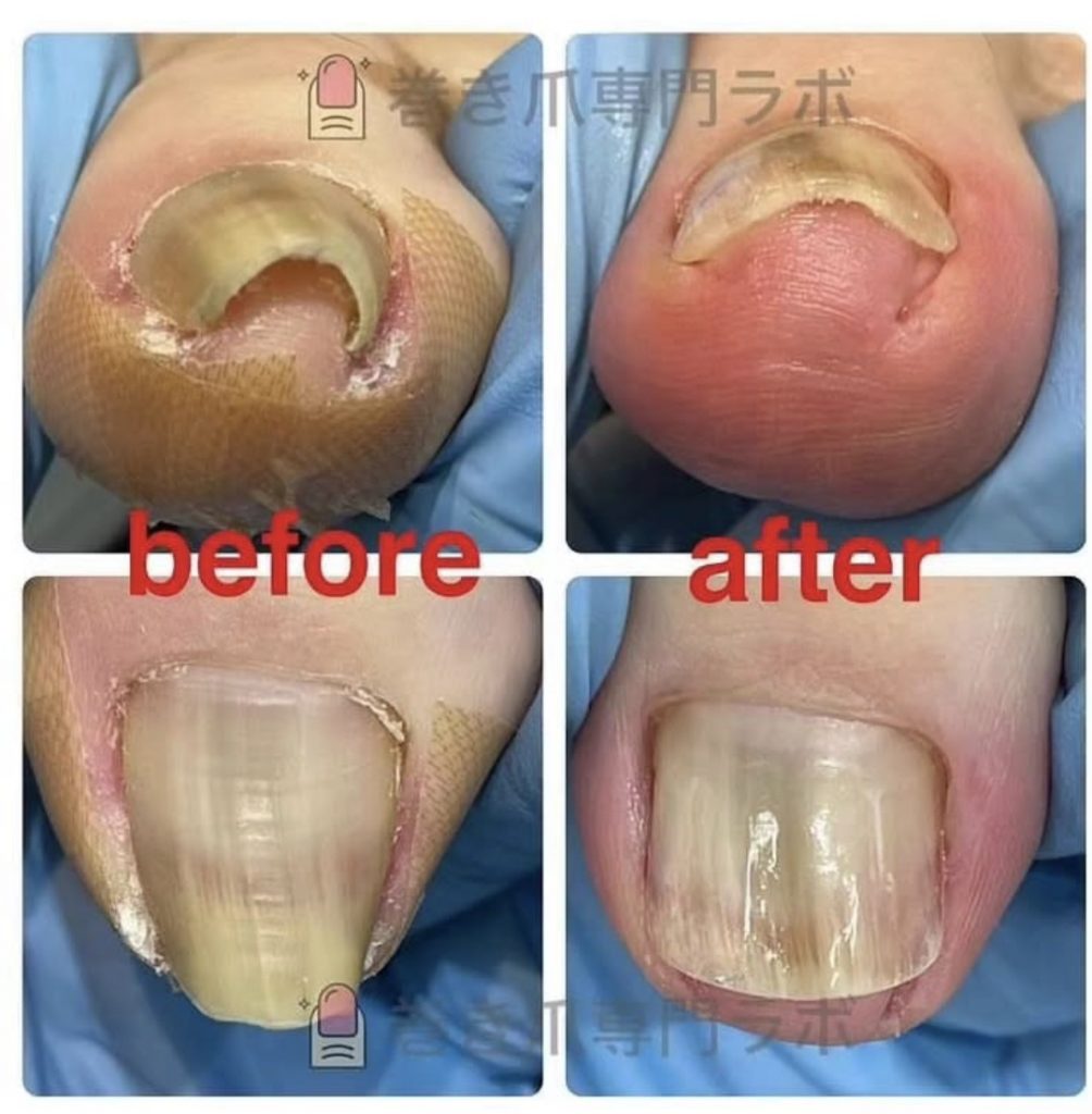 先が細くなった爪