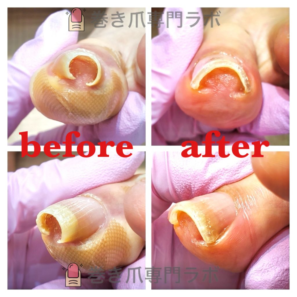 お悩み事のメニュー