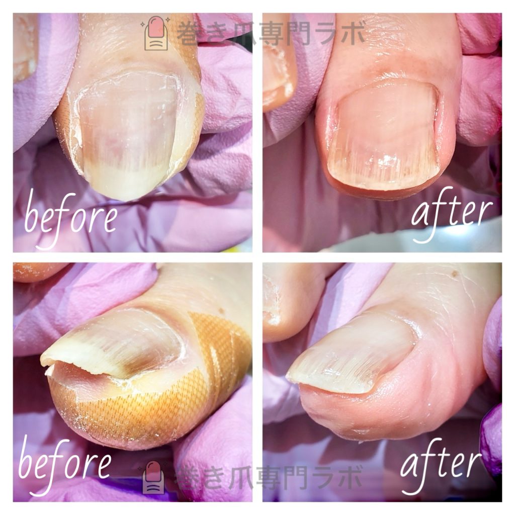 角をカットしてしまう前に！