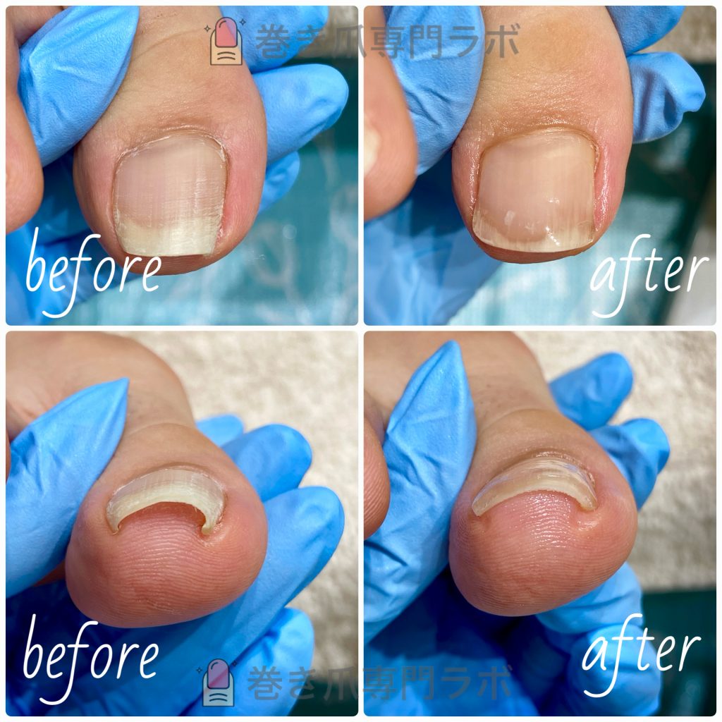 急に痛みに変わることも？！