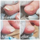 痛みの原因は？