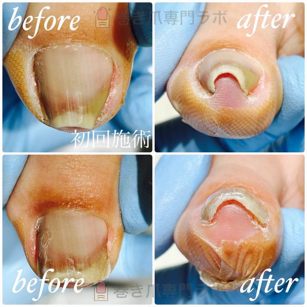 足の爪にも保湿を