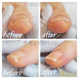 痛みの原因は？