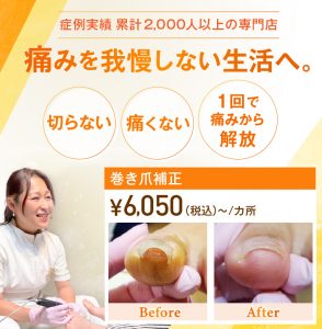 巻き爪は何科？皮膚科・整形外科・形成外科の選び方