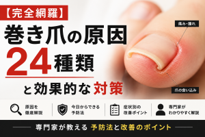 【完全網羅】巻き爪の原因24種類と効果的な対策｜専門家が教える予防法と改善のポイント