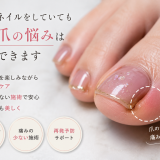 ジェルネイルが巻き爪を引き起こす？5つの影響と後悔しない簡単予防策｜巻き爪専門ラボ