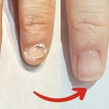 【手の巻き爪】意外と多い手の指の変形！手ならではの5つの原因と正しいセルフケア｜巻き爪専門ラボ