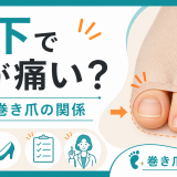 靴下で親指の爪が痛い？巻き爪と圧迫 / 相談の目安