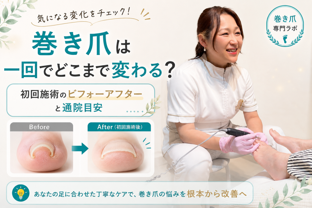 【巻き爪は一回でどこまで変わる？】初回施術のビフォーアフターと通院目安｜巻き爪専門ラボ